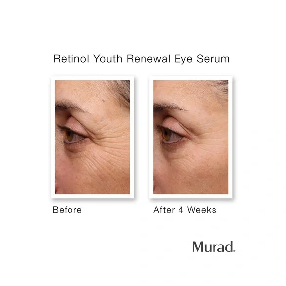 Murad Retinol Youth Renewal Eye Serum 0.5oz NIB💚